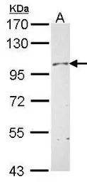 Neuropilin 1 antibody [C1C3]