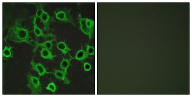 CCRL2 antibody