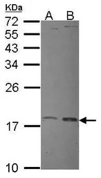 UBE2L3 antibody [N1C3]