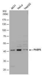 PABPC5 antibody [N1C2]