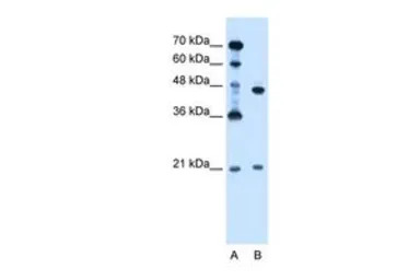 UBE2E2 antibody, N-term