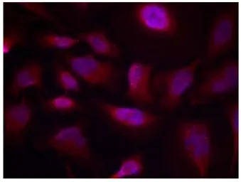 ATF2 (phospho Thr73) antibody