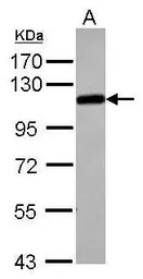 alpha Adducin antibody