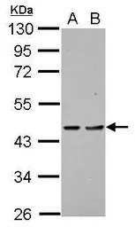 PDCD2 antibody [N1C1]