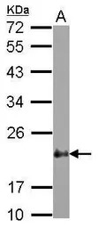CSRP2 antibody [N1C3]