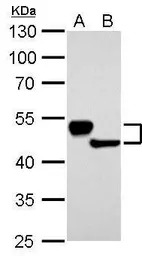 Cytokeratin 13 antibody
