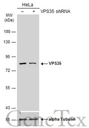VPS35 antibody [C3], C-term
