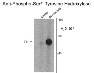 Tyrosine Hydroxylase (phospho 