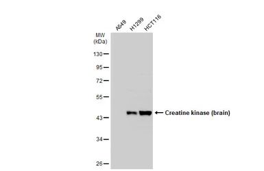 Creatine kinase (brain) antibo
