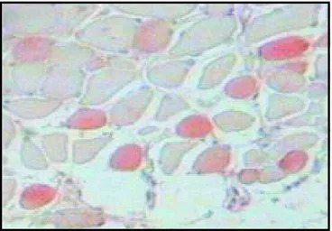 Myosin skeletal slow antibody 