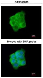 Cytokeratin 13 antibody