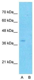 CYTB antibody, N-term