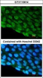 DDX3 antibody [N3C2], Internal