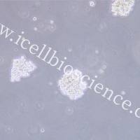 NCI-H1417/NCI-H1417细胞/人小细胞肺癌细胞/STR鉴定