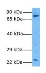 ASPH antibody, N-term