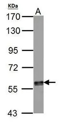 Tyrosine Hydroxylase antibody