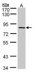 ADAM33 antibody [C2C3], C-term
