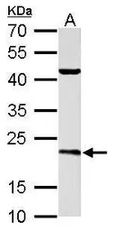 SAR1B antibody