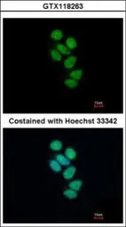 SMNDC1 antibody [N1C3-2]