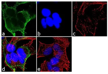 alpha Adaptin antibody [AC1-M1