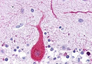 Leukotriene B4 Receptor antibo