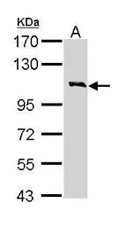 IL3 Receptor beta antibody [N1