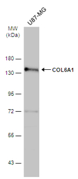 COL6A1 antibody [C1C2], Intern