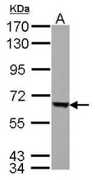 FEM1C antibody