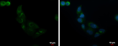 ALS2CR2 antibody [C3], C-term