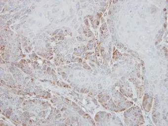 STK33 antibody [N1C3]