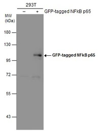 NFkB p65 antibody
