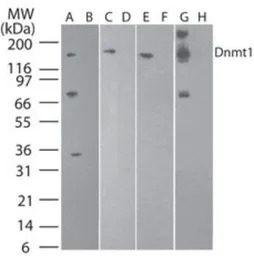 DNMT1 antibody [60B1220.1]