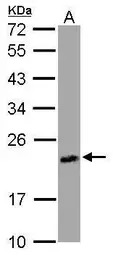 UPRT antibody