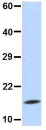 UBE2D3 antibody, N-term