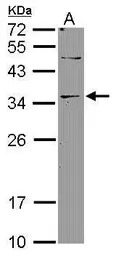DNASE2B antibody [N1C3]