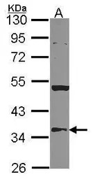 HMGCL antibody [N2C3]