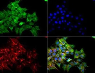 VEGF Receptor 2 antibody