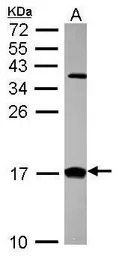 CRABP2 antibody [N1C3]