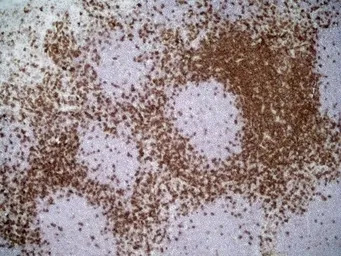 CD4 antibody [W3/25]