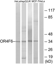 OR4F6 antibody