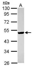 ILKAP antibody [N2C3]