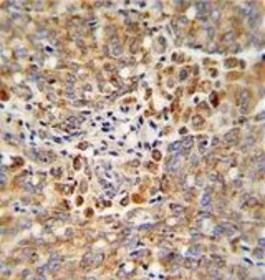 ALKBH3 antibody, C-term