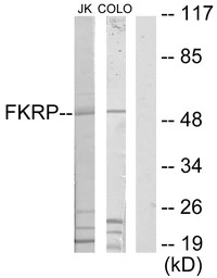 FKRP antibody