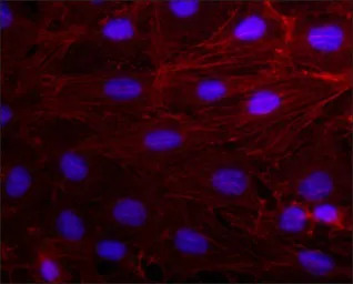 Actin antibody [AC-40]