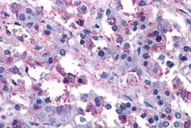 VIP receptor 1 antibody