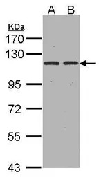 Aminopeptidase A antibody [C2C