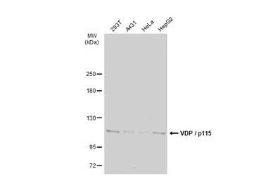 VDP / p115 antibody [N1N2], N-