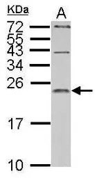 IL1 Receptor antagonist antibo