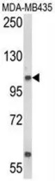 CASD1 antibody, N-term