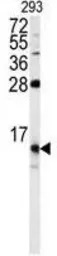 FKBP1B antibody, N-term